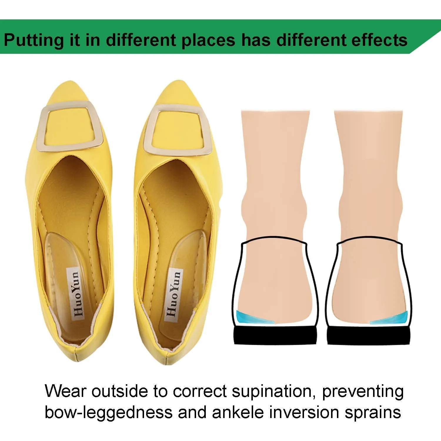 2 Pairs Medial & Lateral Heel Wedge Silicone Insoles - Corrective Adhesive Shoe Inserts for Foot Alignment, Knock Knee Pain, Bow Legs, Osteoarthritis for Men and Women