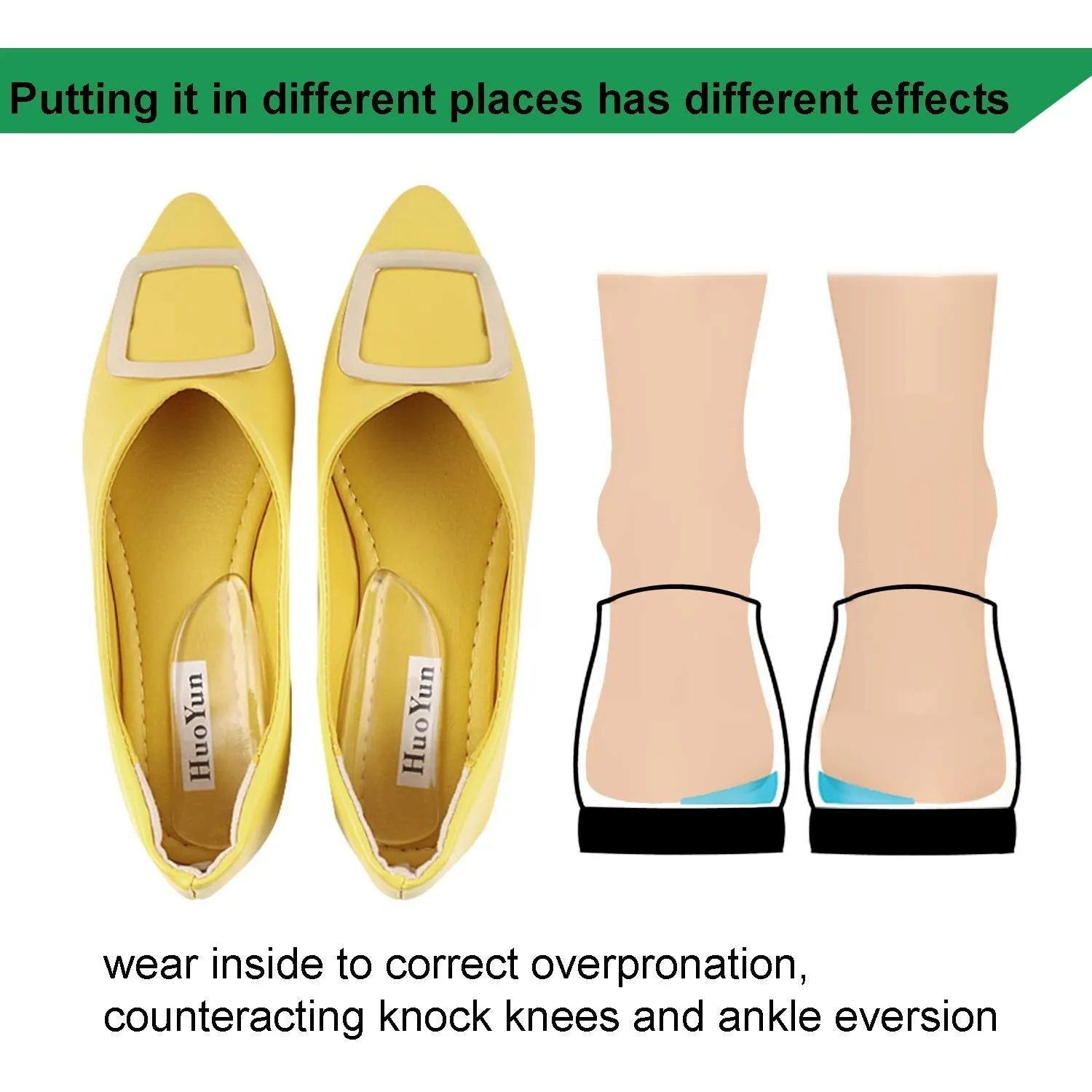 2 Pairs Medial & Lateral Heel Wedge Silicone Insoles - Corrective Adhesive Shoe Inserts for Foot Alignment, Knock Knee Pain, Bow Legs, Osteoarthritis for Men and Women